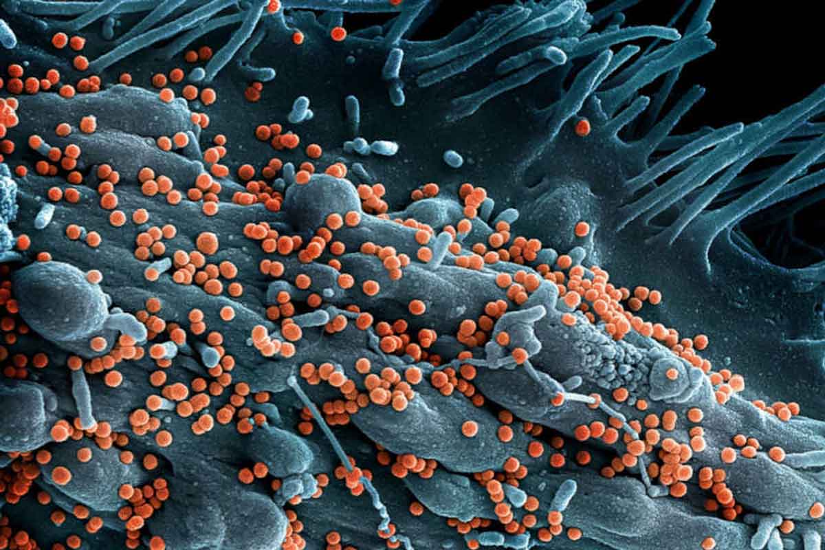 Lassa fever deaths hit 258 as fatality rate rises to 24%