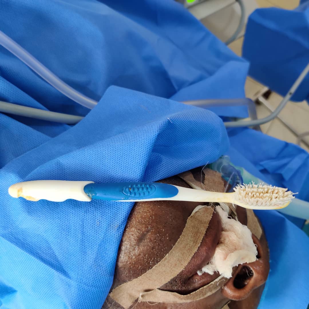 FMC rescues man who swallowed toothbrush